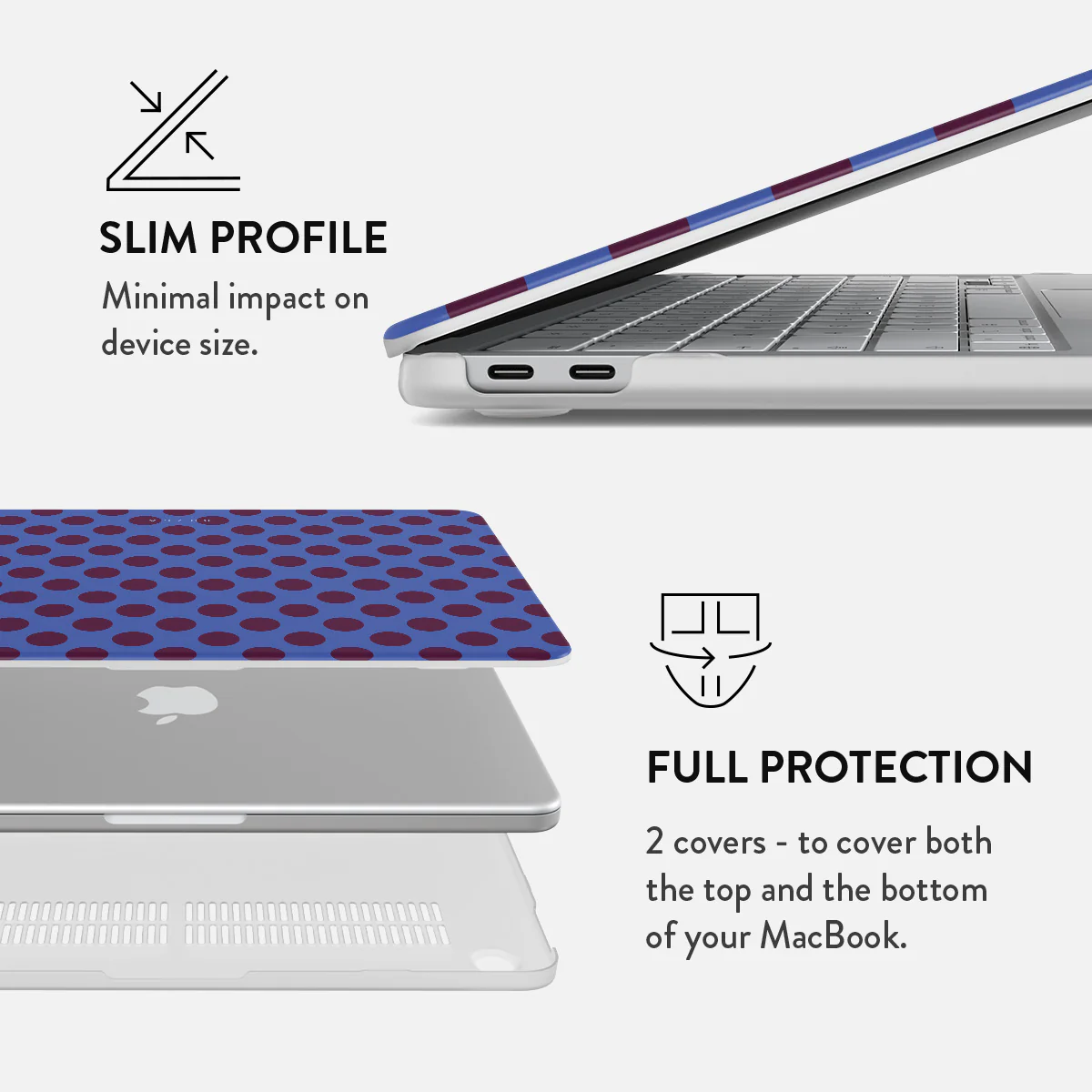 On Pause - Macbook Case - Image 20