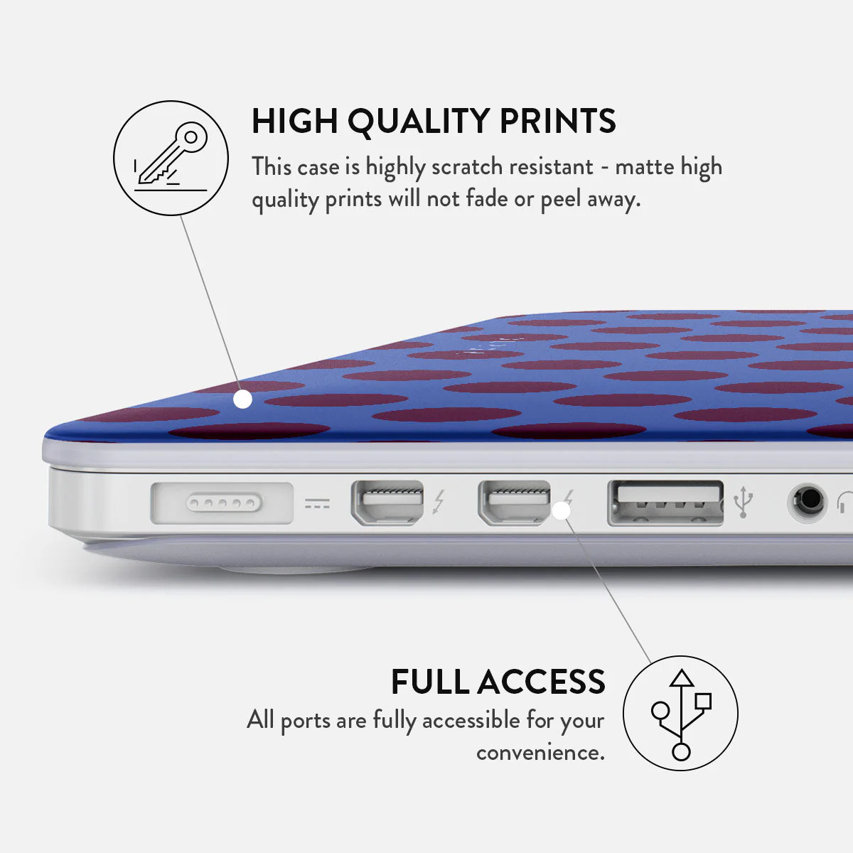 On Pause - Macbook Case - Image 23
