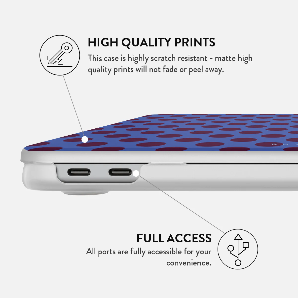 On Pause - Macbook Case - Image 24